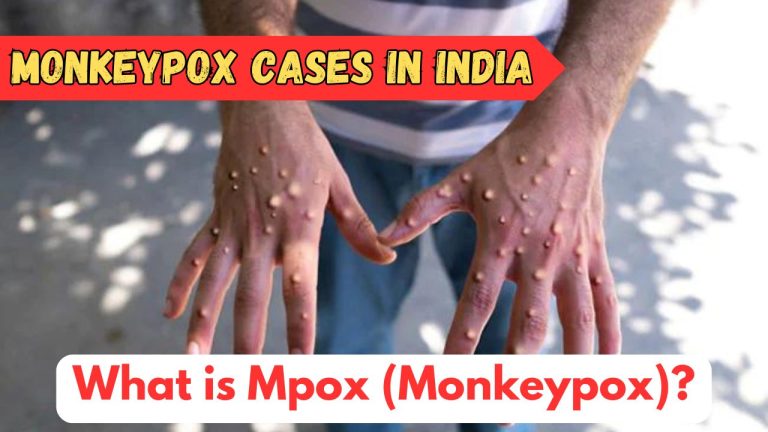 monkeypox outbreak